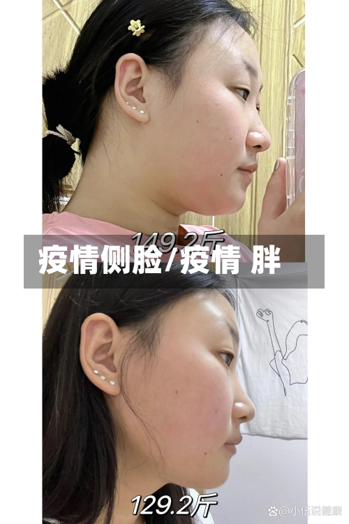 疫情侧脸/疫情 胖